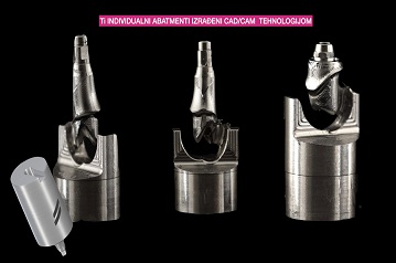 individualni abatmenti